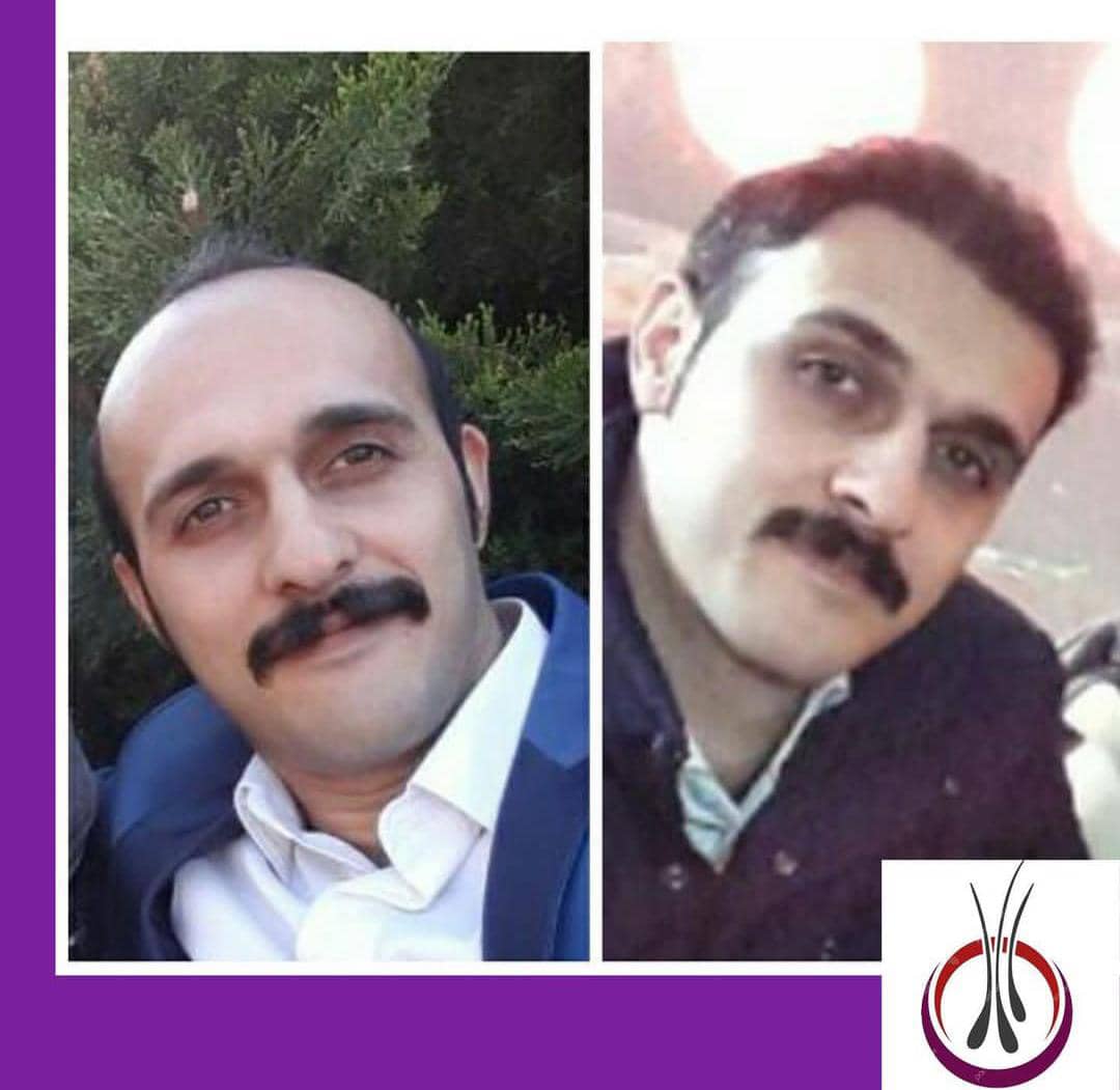 فرآیند سریع و نتایج دائمی